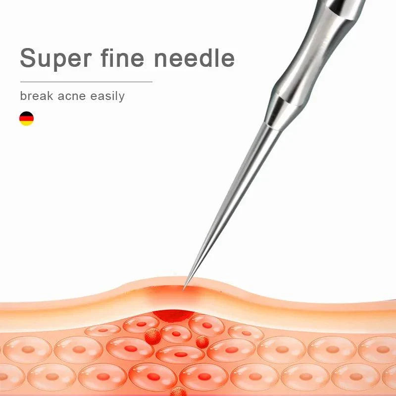 Acne Blackhead, Pimples tweezers Beauty Artifact Blemish Extractor Remover Needle Tool