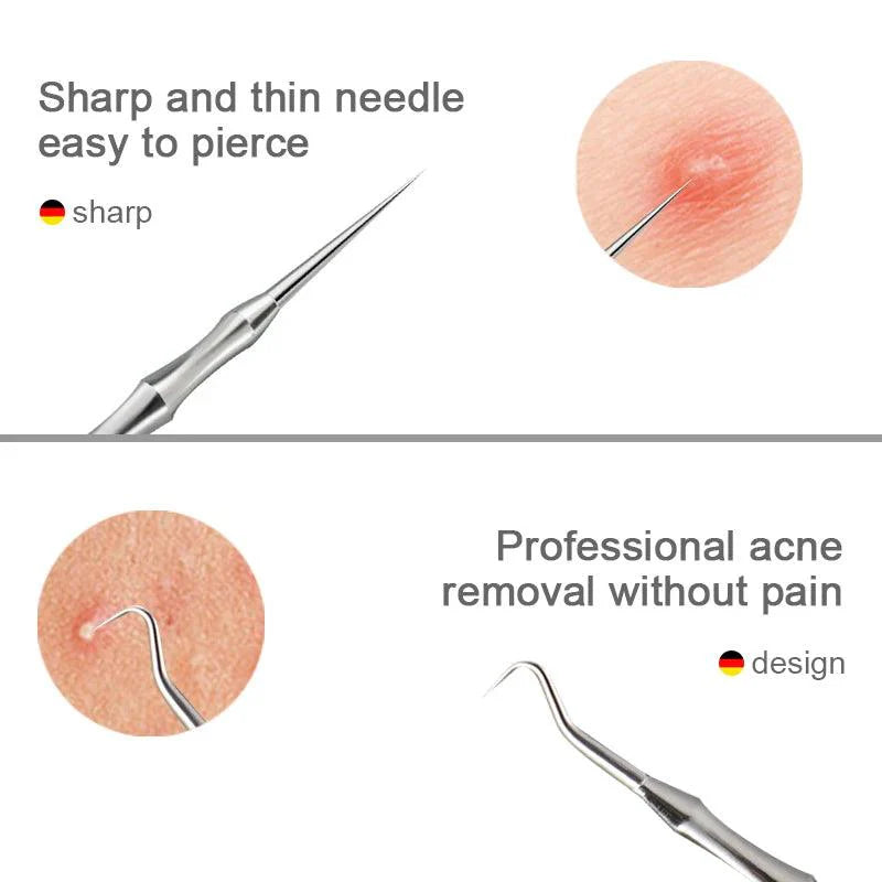 Acne Blackhead, Pimples tweezers Beauty Artifact Blemish Extractor Remover Needle Tool